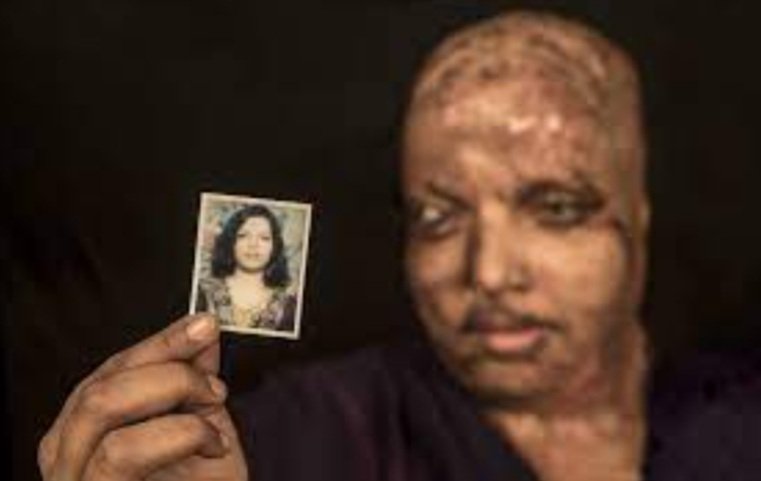 Prime Accused In Pramodini Roul Acid Attack Case Gets 14-Year RI