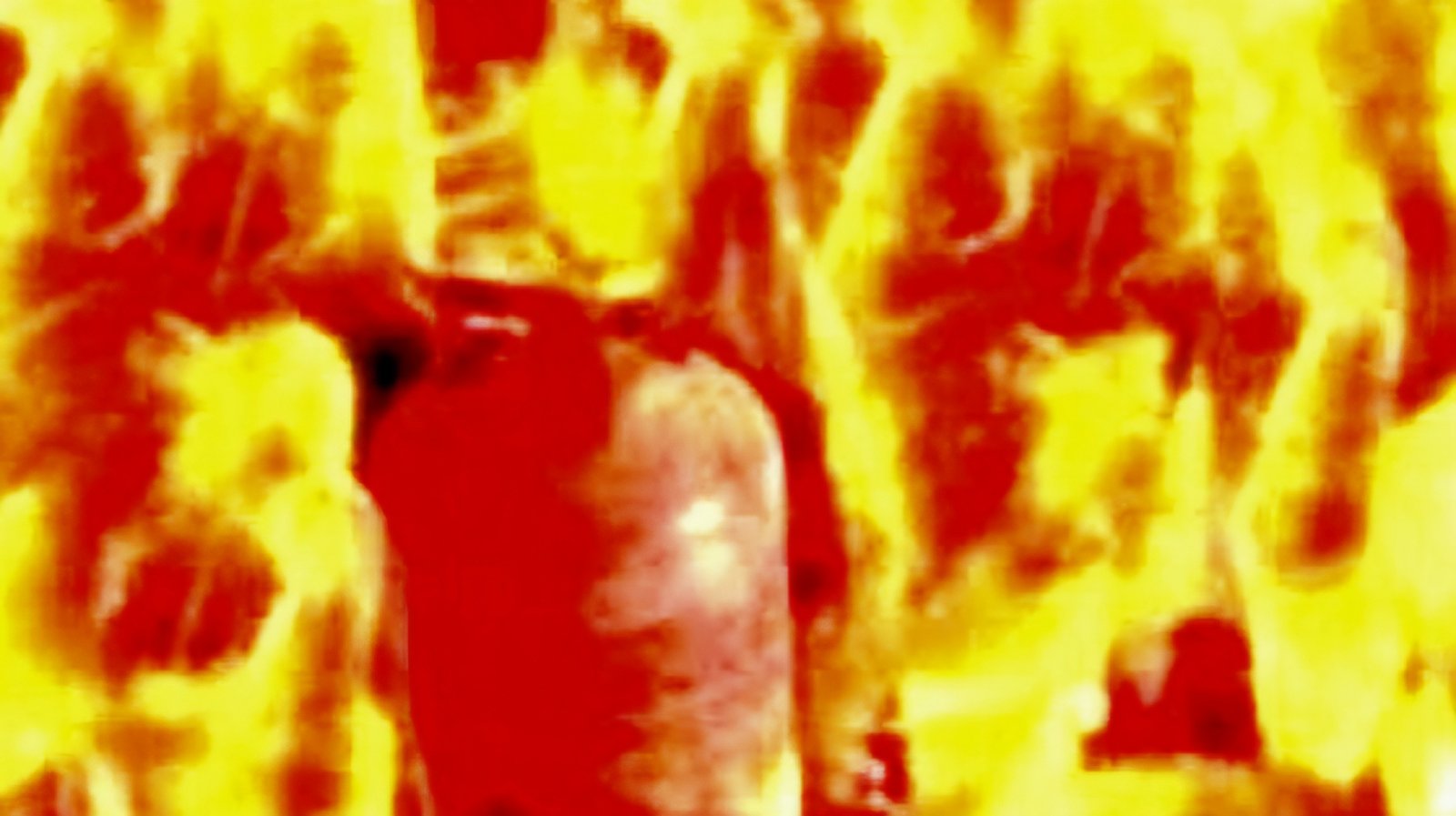 Three critically injured in LPG cylinder blast in Odisha’s Rayagada