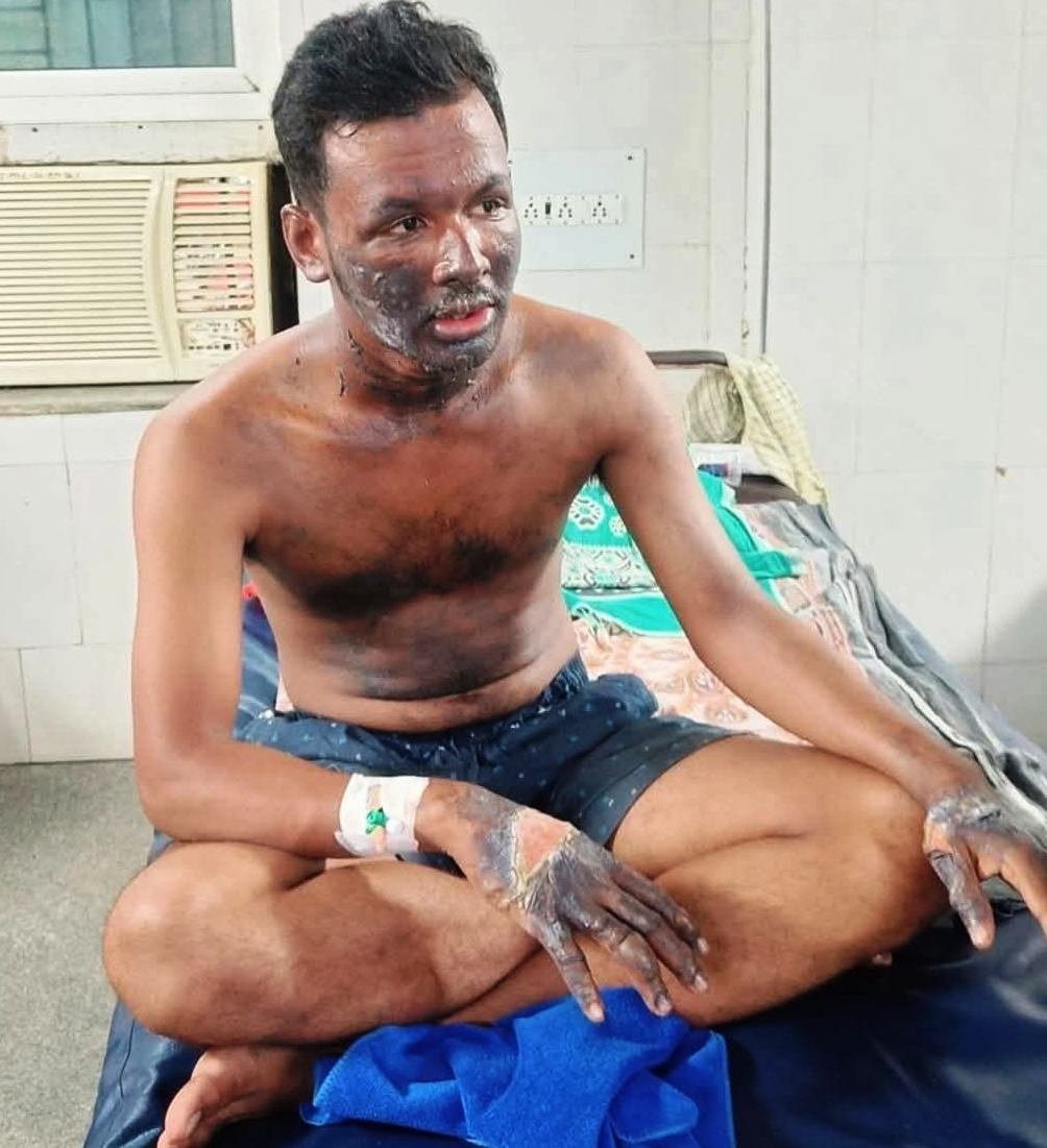 Minister assures best medical care for brave student injured in Balasore college tragedy