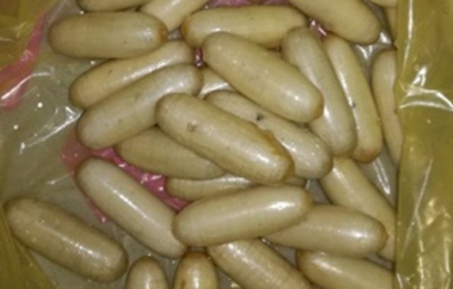 ମହିଳାଙ୍କ ପେଟରୁ ବାହାରିଲା ୧୫ କୋଟି ଟଙ୍କାର କୋକେନ