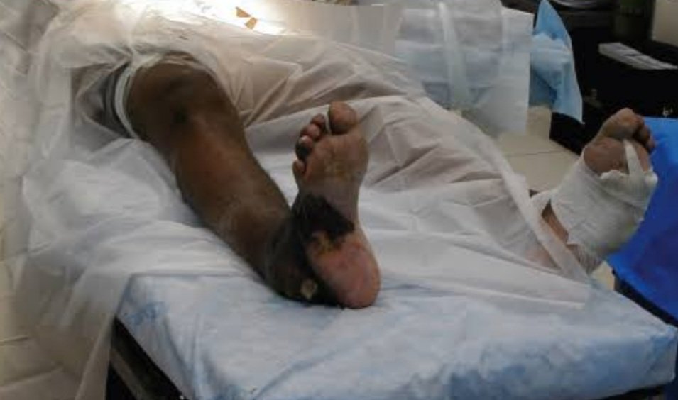 ମୃତକଙ୍କୁ ଚିହ୍ନଟ ପାଇଁ କେବଳ ଏମ୍ସରେ ପହଞ୍ଚିବାକୁ ସୂଚନା