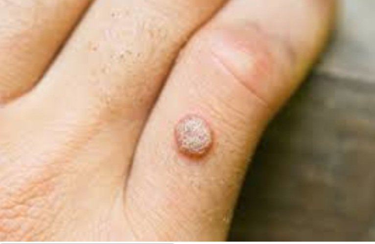 ଭାତୁଡ଼ି ହଟାଇବାର ଘରୋଇ ଉପାୟ