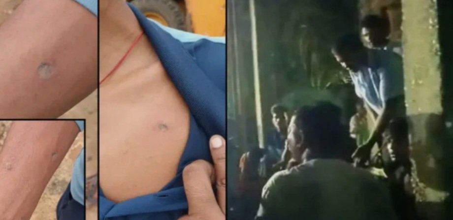  ବର୍ବର କାଣ୍ଡ : ୨ ନାବାଳକଙ୍କୁ ଲୁହା ରଡରେ ନିସ୍ତୁକ ମାଡ଼ ସହ ସିଗାରେଟ ଚେଙ୍କ  ଦେଲେ