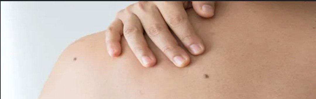 ଶରୀରର ଏହି ସ୍ଥାନରେ କଳାଜାଇ ରହିବା ଶୁଭ 