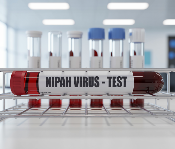 ନିପା ଭାଇରସ ପାଇଁ ସତର୍କ କଲେ ଡବ୍ଲୁଏଚ୍‌ଓ