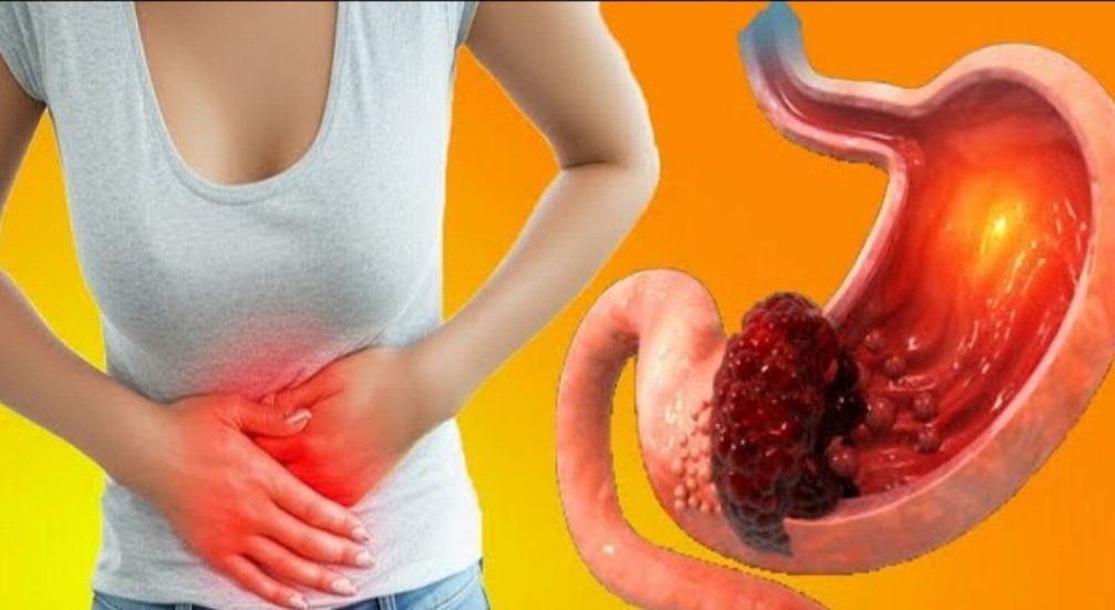 ଅଜୀର୍ଣ୍ଣ ସମସ୍ୟାର ସମ୍ମୁଖୀନ ହେଉଥିଲେ ଆପଣାନ୍ତୁ ଏହି ଉପାୟ....