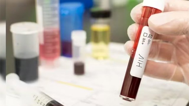 ଏଚ୍‌ଆଇଭି ଇଞ୍ଜେକସନ୍ ଫୋଡିଦେଲା ବୋଲି ଆତ୍ମହତ୍ୟା କଲେ ଯୁବତୀ