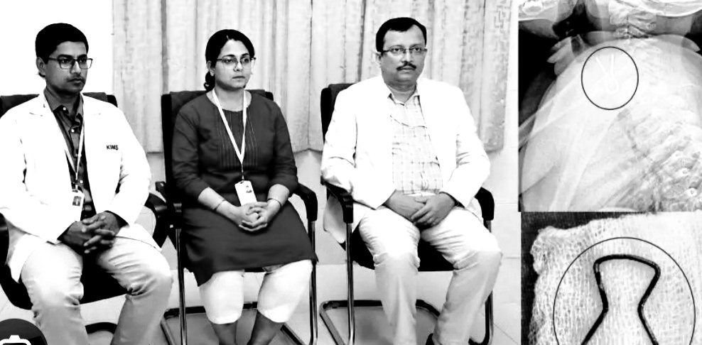 ଆଡ୍‌ଭାନ୍ସ ଏଣ୍ଡୋସ୍କୋପି ପଦ୍ଧତିରେ ଶିଶୁ ଖାଦ୍ୟନଳୀରୁ ପିନ୍‌ ବାହାର କଲେ ଡାକ୍ତର